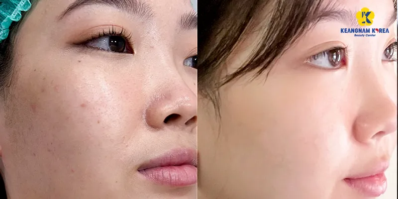 6 Cách làm trắng da mặt nhanh nhất trong 1 tuần