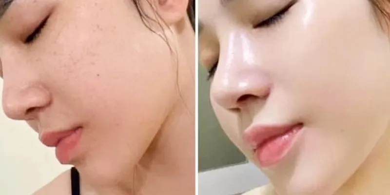 7 cách làm da mặt trắng hồng tự nhiên cho làn da xỉn màu
