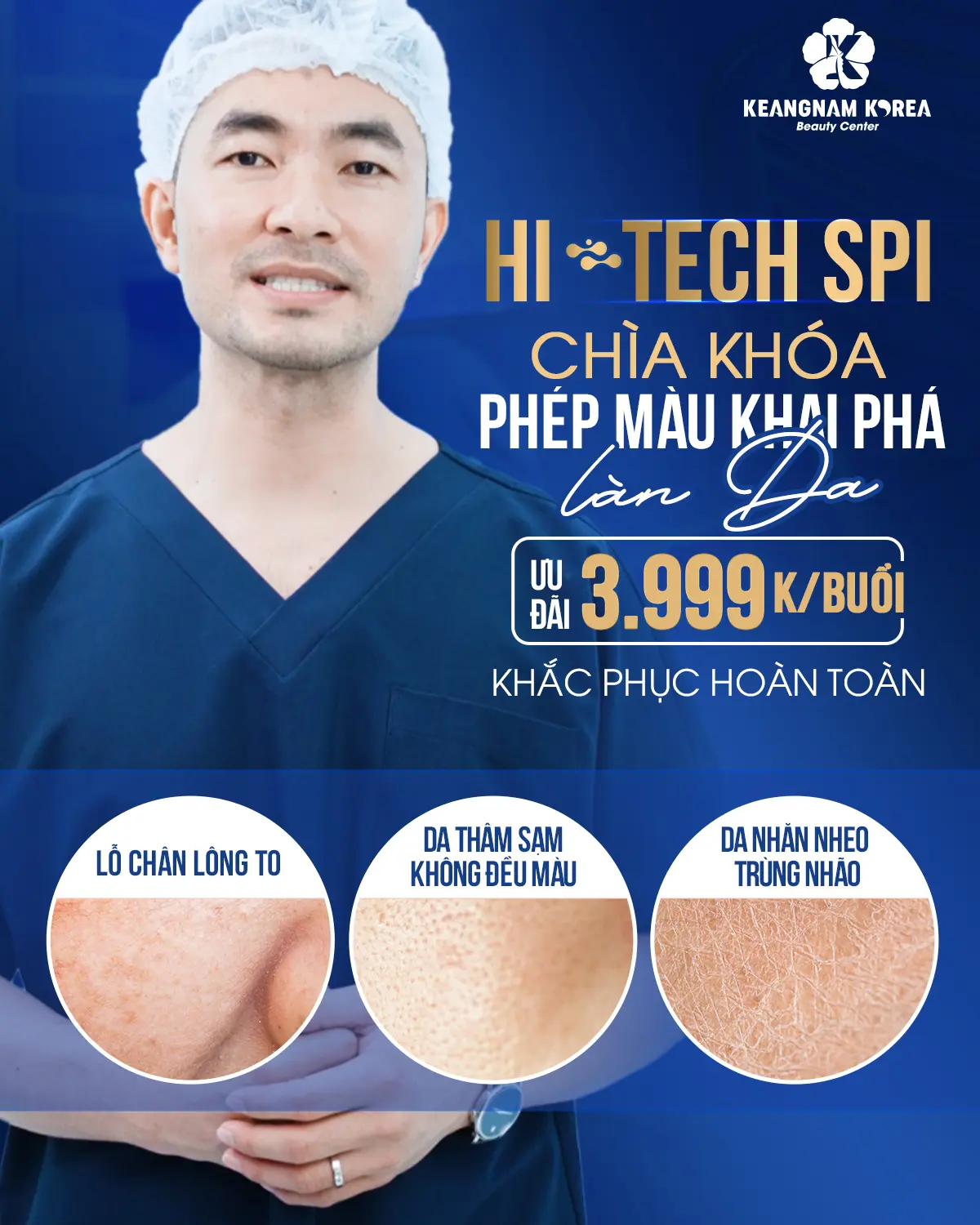 Phân tích Hi Tech SPI