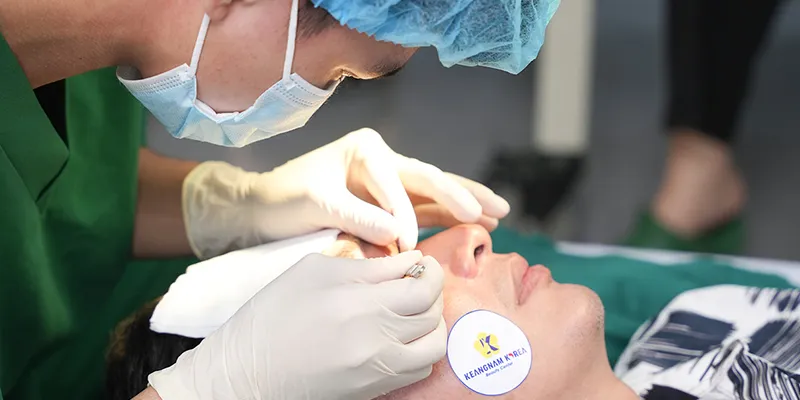 Cắt mí mắt có được vĩnh viễn không?
