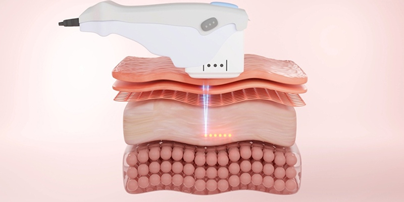 5 công nghệ chăm sóc da mới nhất