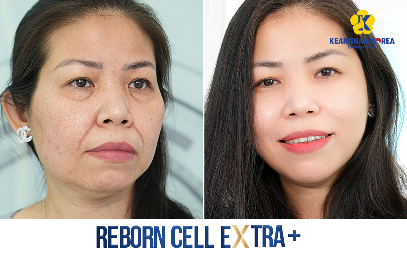 Is Vietnam Safe for Plastic Surgery? 5 Is Vietnam Safe for Plastic Surgery?