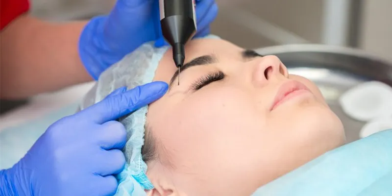 4 phương pháp cắt mí hiện đại nhất hiện nay  
