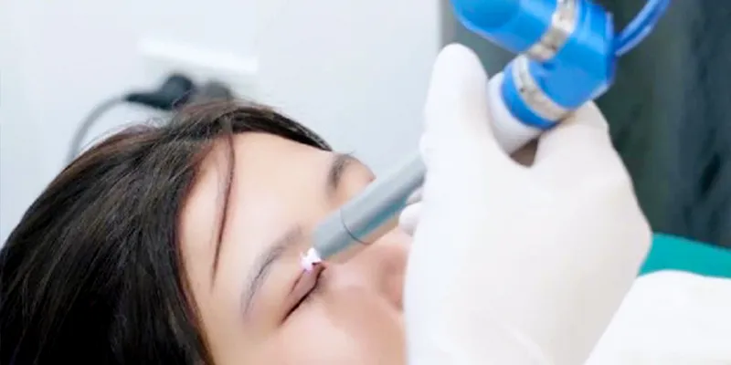 4 phương pháp cắt mí hiện đại nhất hiện nay  