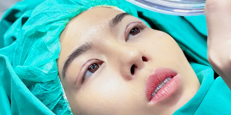 4 phương pháp cắt mí hiện đại nhất hiện nay  