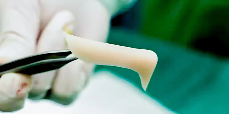 sụn Softxil