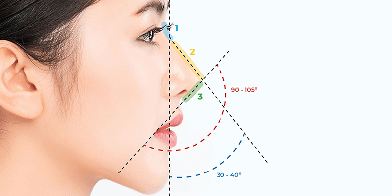 các loại chỉ nâng mũi