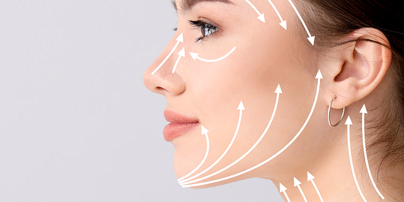 Căng chỉ collagen là gì