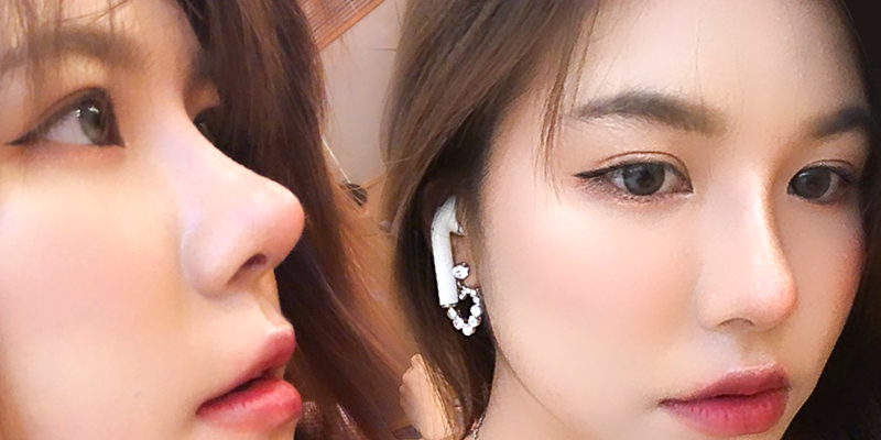 sửa mũi ở đâu đẹp