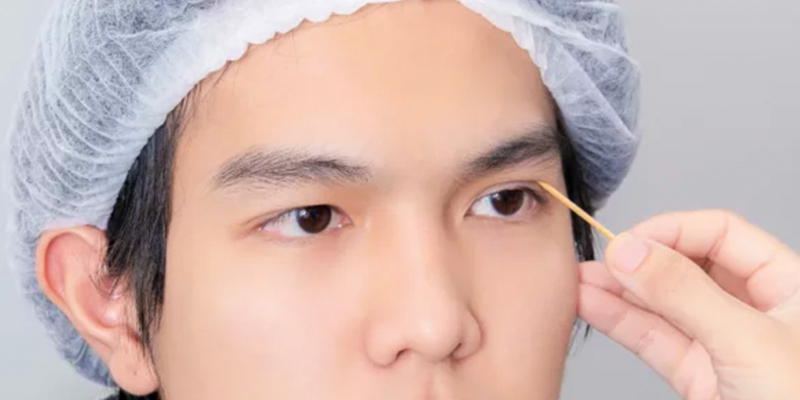 Blepharoplasty for Men: Techniques, Cost, Recovery and Results 2 Blepharoplasty for Men