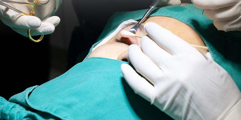 Blepharoplasty for Men: Techniques, Cost, Recovery and Results 3 Blepharoplasty for Men