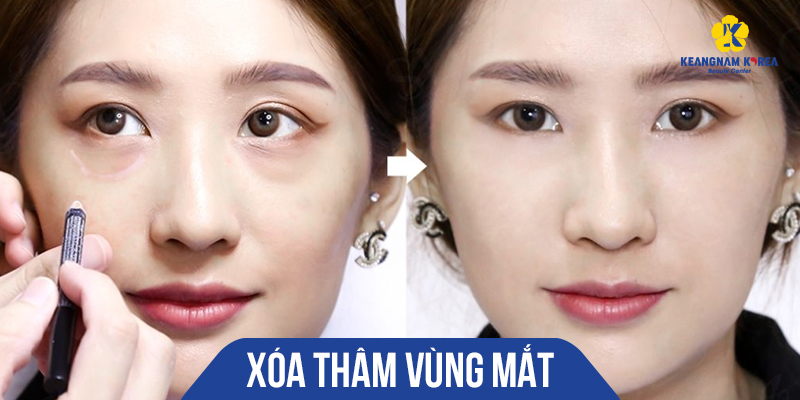 cách làm căng vùng da dưới mắt