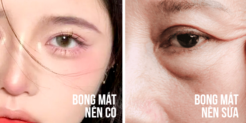 cách tạo bọng mắt dưới