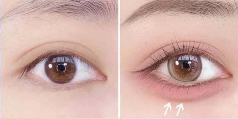 Bọng mắt có đẹp không? Có bọng mắt đẹp hay xấu?    2 bọng mắt có đẹp không