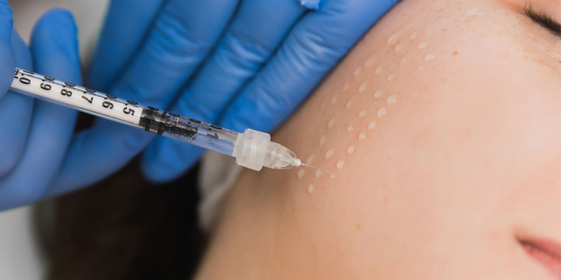 Tiêm meso bao lâu tiêm lại