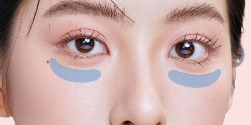 Cắt mí dưới có để lại sẹo không?