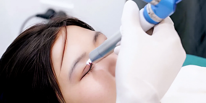 Bảng giá cắt mí plasma mới nhất 2026
