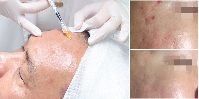 chăm sóc da mặt cho nam