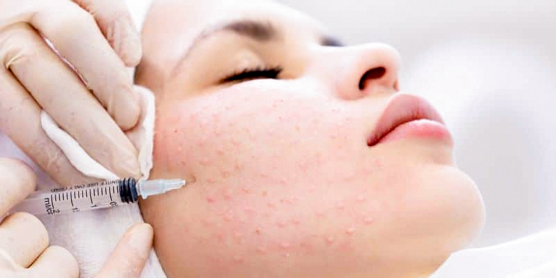 tiêm meso giá bao nhiêu