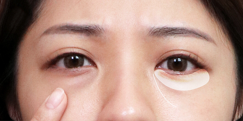 xóa bọng mắt không phẫu thuật