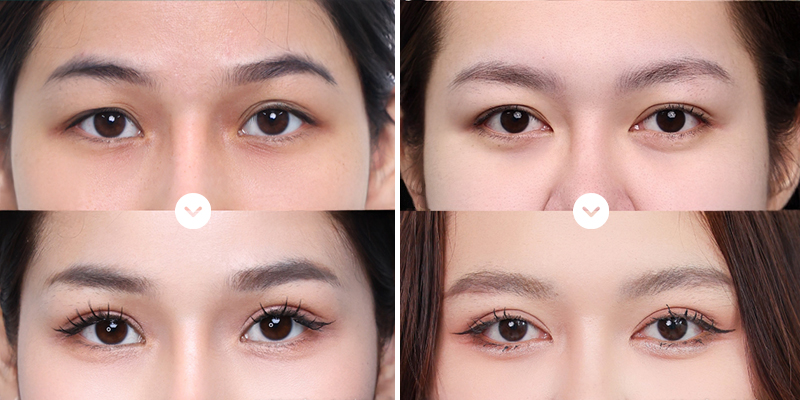 Ưu nhược điểm của phương pháp nhấn mí là gì? 2 Ưu nhược điểm của phương pháp nhấn mí là gì