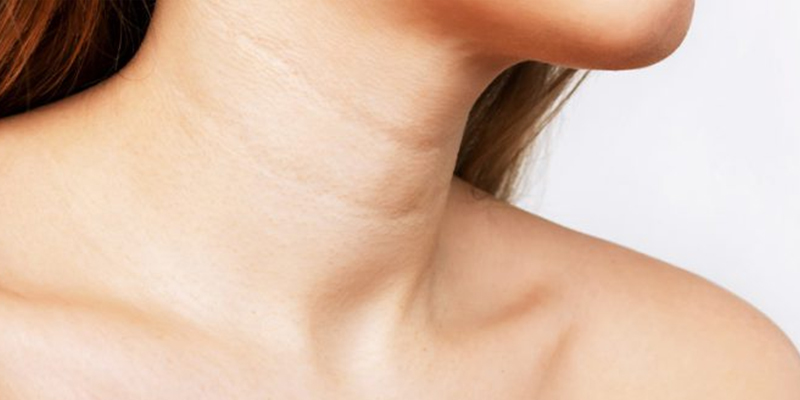 9 cách làm căng da cổ, chống nhăn, chùng nhão tức thì 1 cách làm căng da cổ