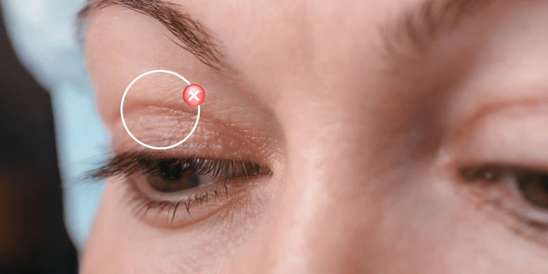 8 cách vệ sinh mắt sau khi nhấn mí và các lưu ý quan trọng 4 cách vệ sinh mắt sau khi nhấn mí