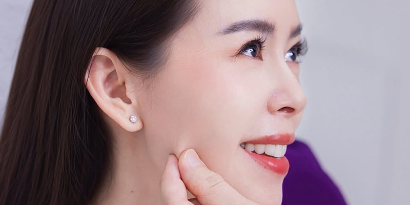 Căng chỉ vùng mắt gồm những phương pháp nào? Giá bao nhiêu? 5 căng chỉ vùng mắt