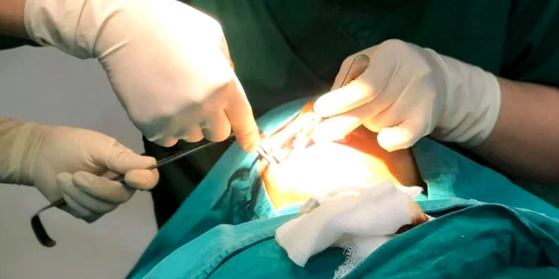 Kinh nghiệm căng da mặt: hướng dẫn chuẩn bị trước & sau khi phẫu thuật để đạt hiệu quả trẻ hóa cao 4 kinh nghiệm căng da mặt