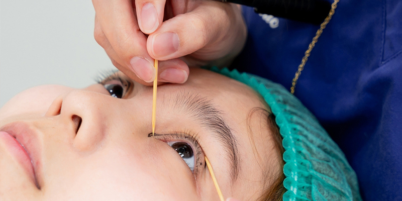 nhấn mí có giữ được lâu không