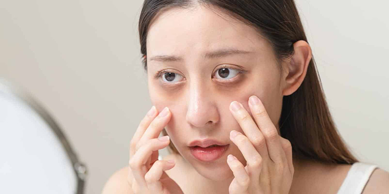 Tiêm trị thâm mắt có an toàn không? Hiệu quả bao lâu và làm sao đảm bảo an toàn tối đa? 1 Tiêm trị thâm mắt có an toàn không