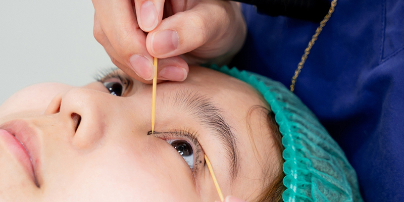 Bấm mí hay cắt mí đẹp hơn? Có nên bấm mí mắt không? 5 Bấm mí vĩnh viễn có đúng không