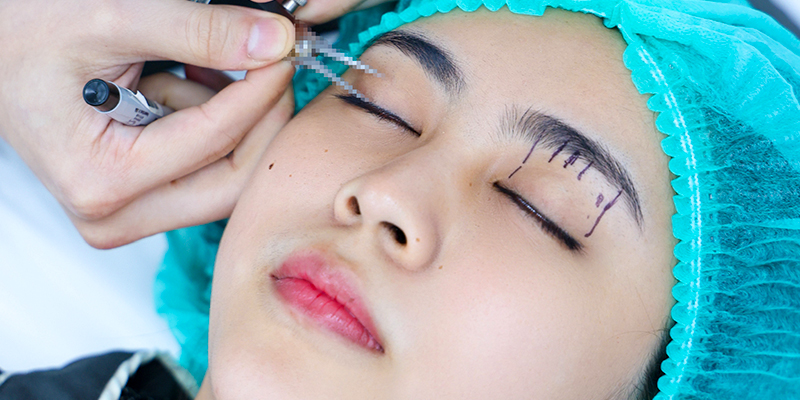 Mắt 3 mí là sao? Cách khắc phục và làm mắt 3 mí thành 2 mí 4 làm mắt 3 mí thành 2 mí?