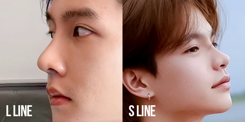 Nâng mũi nam giới có những kiểu nào? Ở đâu tốt? Giá bao nhiêu? 3 Nâng mũi nam giới có những kiểu nào