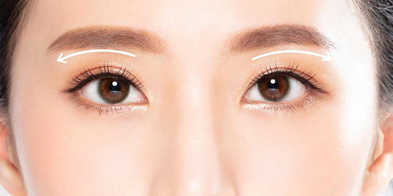 Bấm mí hay cắt mí đẹp hơn? Có nên bấm mí mắt không? 1 bấm mí hay cắt mí đẹp hơn