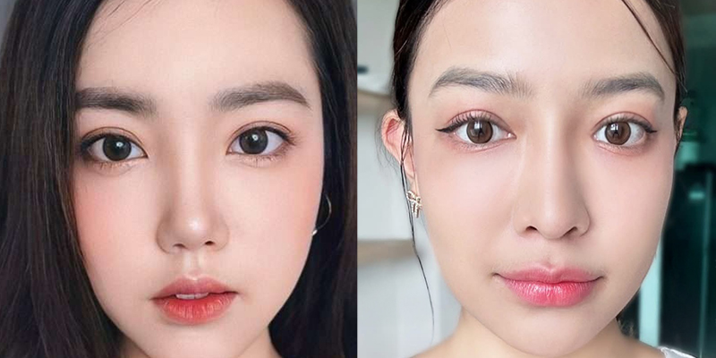 Bấm mí hay cắt mí đẹp hơn? Có nên bấm mí mắt không? 4 bấm mí hay cắt mí đẹp hơn