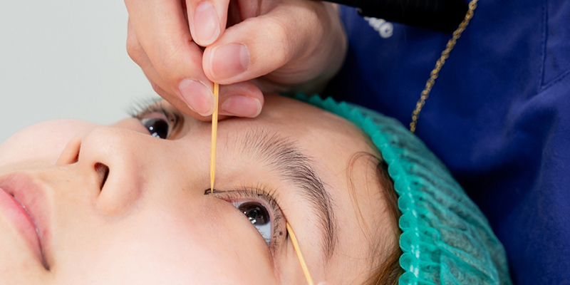 Bấm mí mắt hàn quốc ở đâu đẹp? Top 5 địa chỉ bấm mí đẹp tại TP.HCM 2 bấm mí mắt hàn quốc ở đâu đẹp