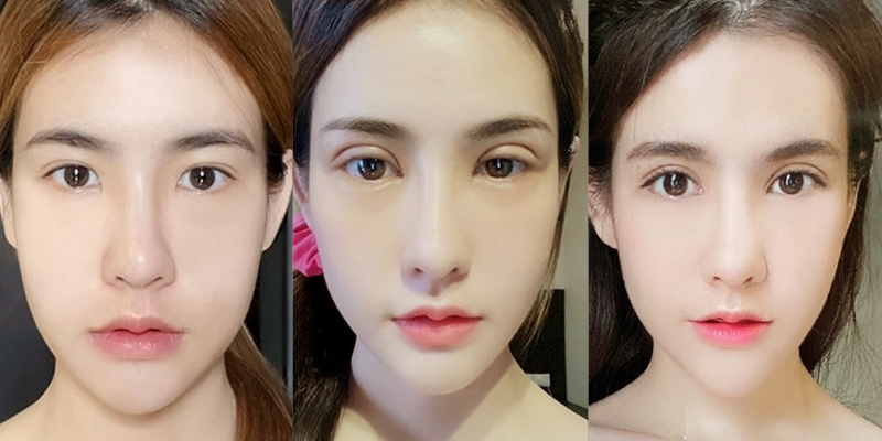 Bấm mí hay cắt mí đẹp hơn? Có nên bấm mí mắt không? 3 cắt mí mắt là gì