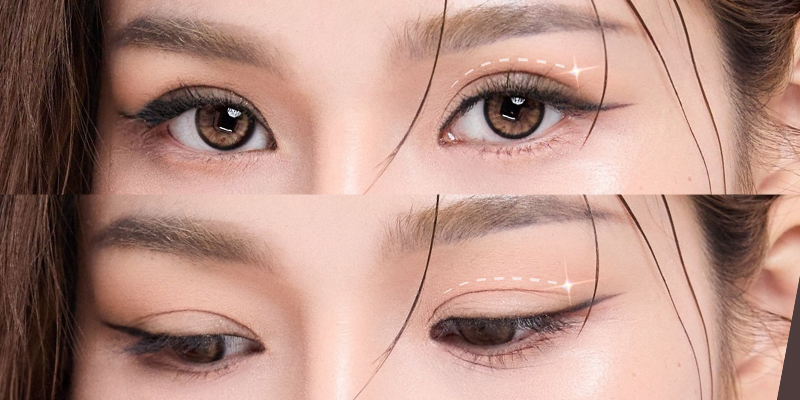 Cắt mí mắt có thay đổi vận mệnh không? 3 cắt mí mắt có thay đổi vận mệnh không