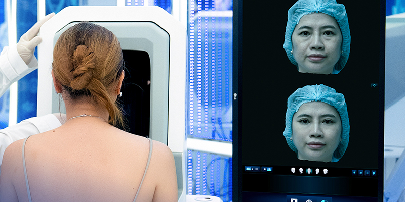 Cắt mí mắt có thay đổi vận mệnh không? 4 cắt mí mắt có thay đổi vận mệnh không