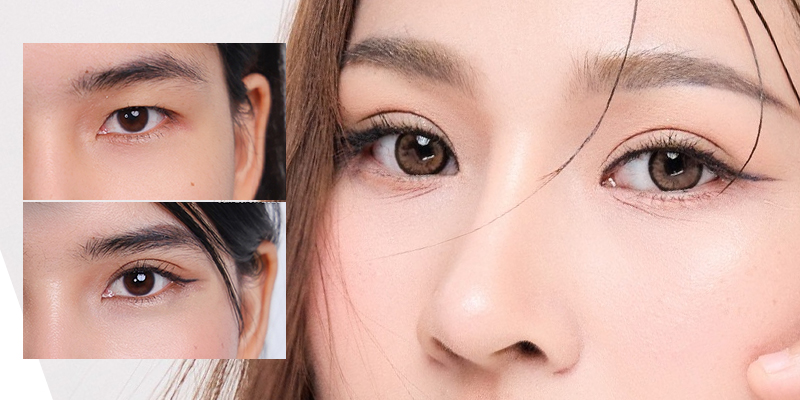 Cắt mí mắt có thay đổi vận mệnh không? 1 cắt mí mắt có thay đổi vận mệnh không