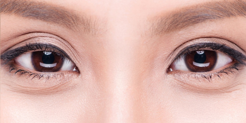 Mắt 3 mí là sao? Cách khắc phục và làm mắt 3 mí thành 2 mí 1 mắt 3 mí là sao