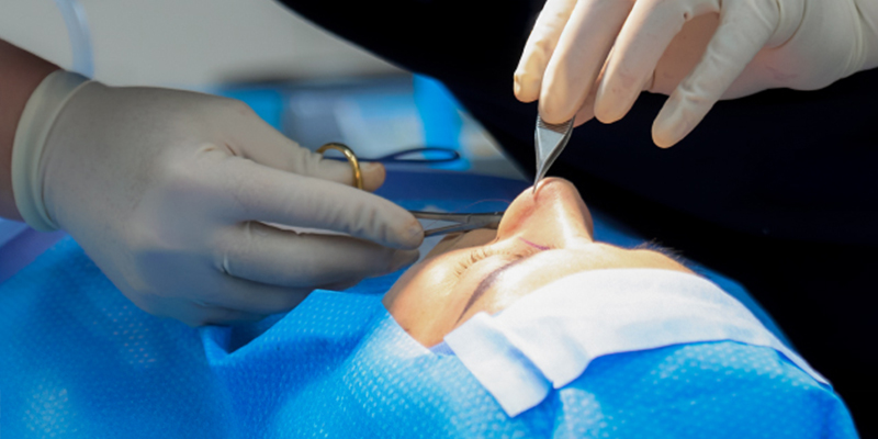 Nâng mũi bằng phương pháp nào an toàn nhất? 2 nâng mũi bằng phương pháp nào an toàn nhất