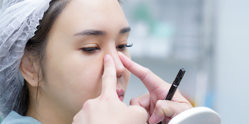 Nâng mũi bao nhiêu ngày thì cắt chỉ? 4 nâng mũi bao nhiêu ngày thì cắt chỉ