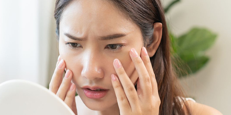 Phẫu thuật nâng cơ mí mắt là gì? 4 nâng cơ mí mắt là gì