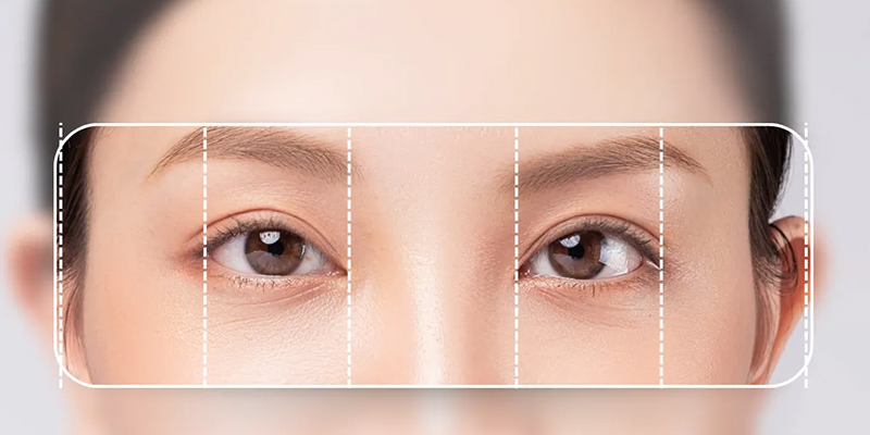 Phẫu thuật nâng cơ mí mắt là gì? 1 nâng cơ mí mắt là gì