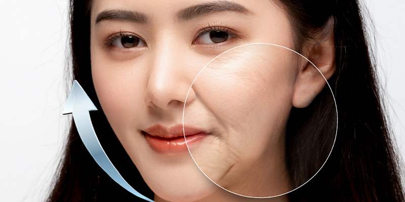 Quy trình căng da mặt gồm những gì: thời gian, hiệu quả & mức độ an toàn 1 quy trình căng da mặt