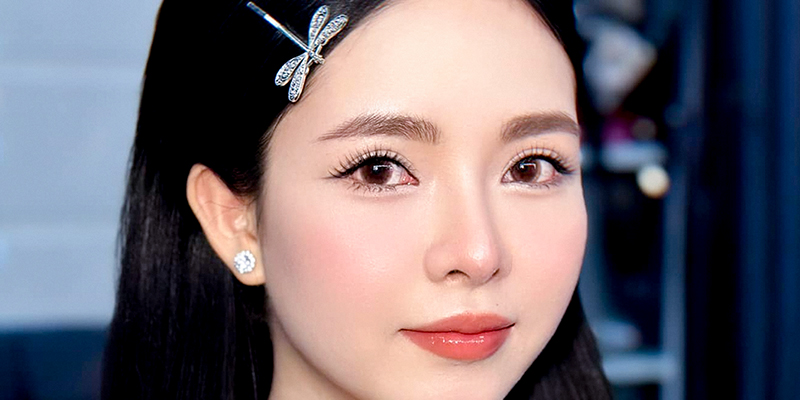 Review Cắt Mí Mắt Ở Đâu Đẹp Tại Hồ Chí Minh? Top Địa Chỉ Uy Tín Được Đánh Giá Cao 5 Hình ảnh cắt mí tại Keangnam Korea sau 6 tháng