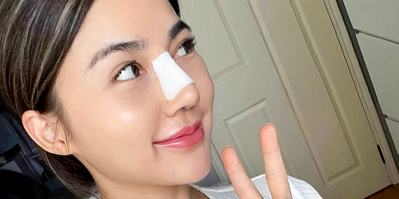 Gợi ý thực đơn cho người mới nâng mũi và những đại kỵ cần tránh 1 thực đơn cho người mới nâng mũi