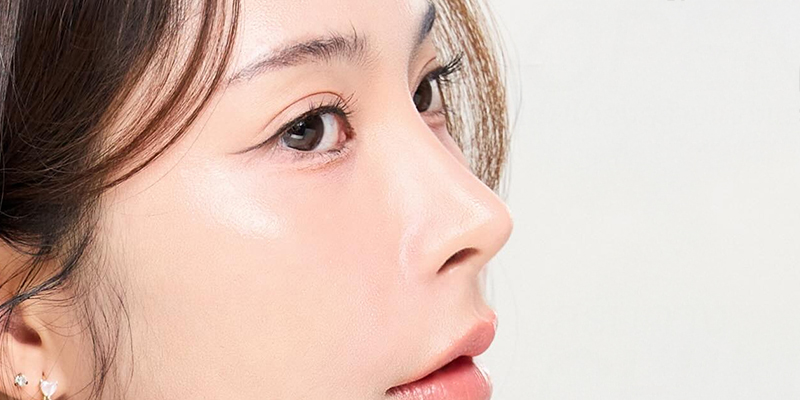 Tiêm tan filler bao lâu thì nâng mũi được? 1 tiêm tan filler bao lâu thì nâng mũi được